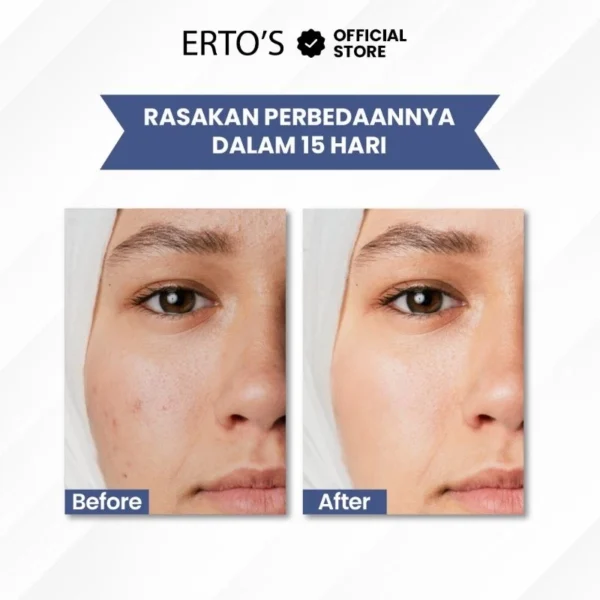 Erto’s Glowing Night Cream – Bangun dengan Kulit Cerah & Kenyal